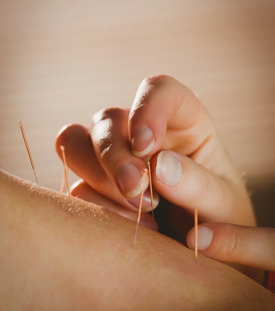 NAET Treatments
