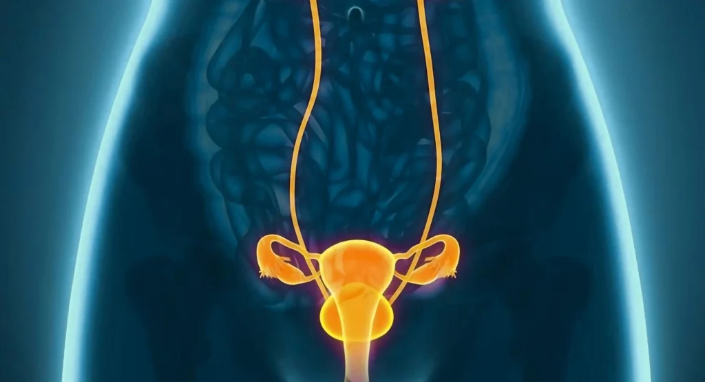 Symptoms What Interstitial Cystitis Feels Like