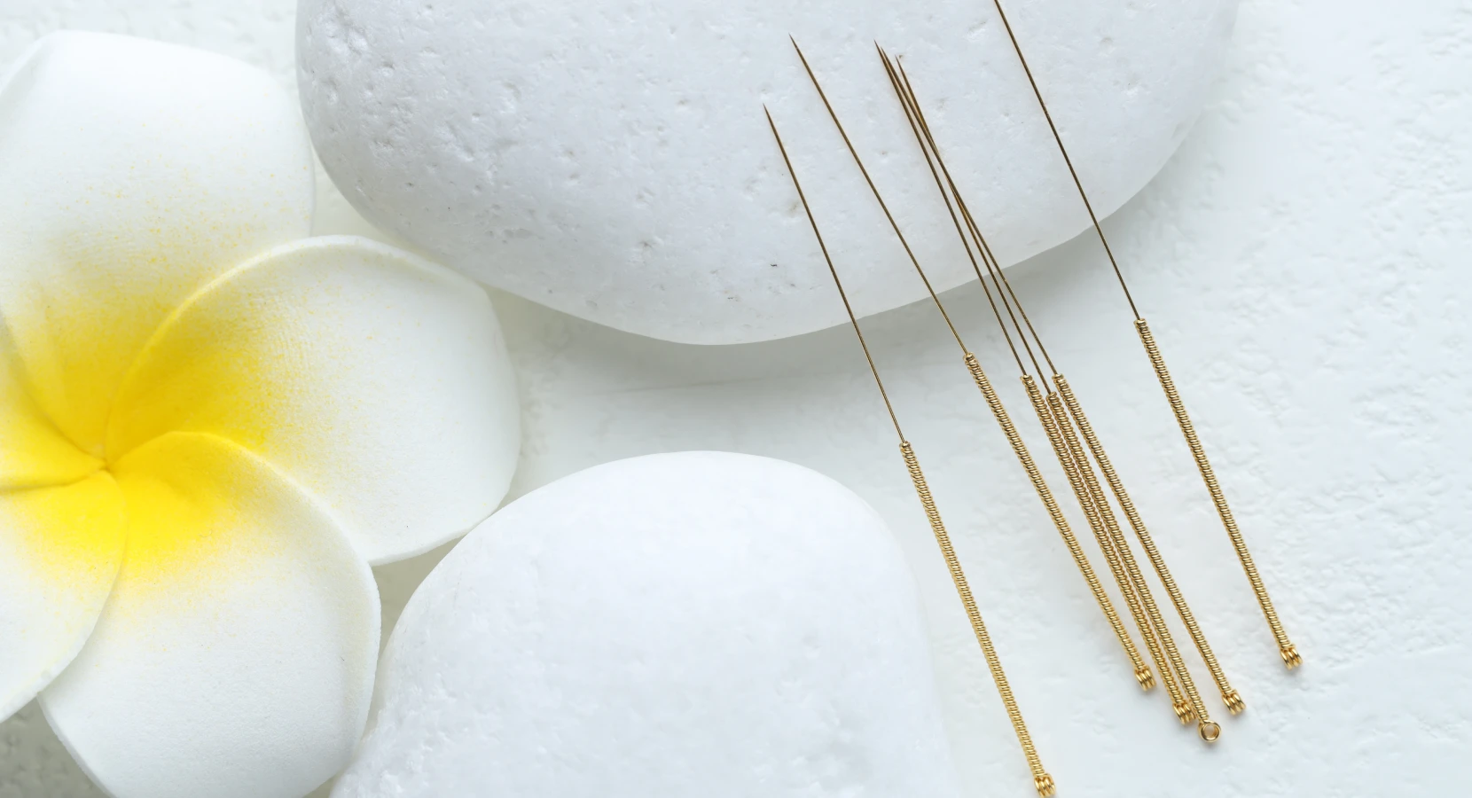 What Is Acupuncture for Endometriosis and How Does It Help?